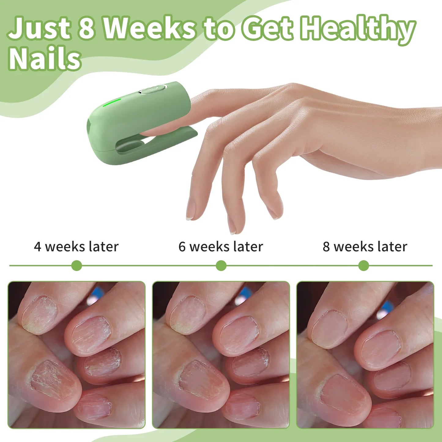 Nail Fungus Cleaning Device, Nail Fungus Cleaning Machine, Portable Nail Thickening and Decolorization Fungus Remover