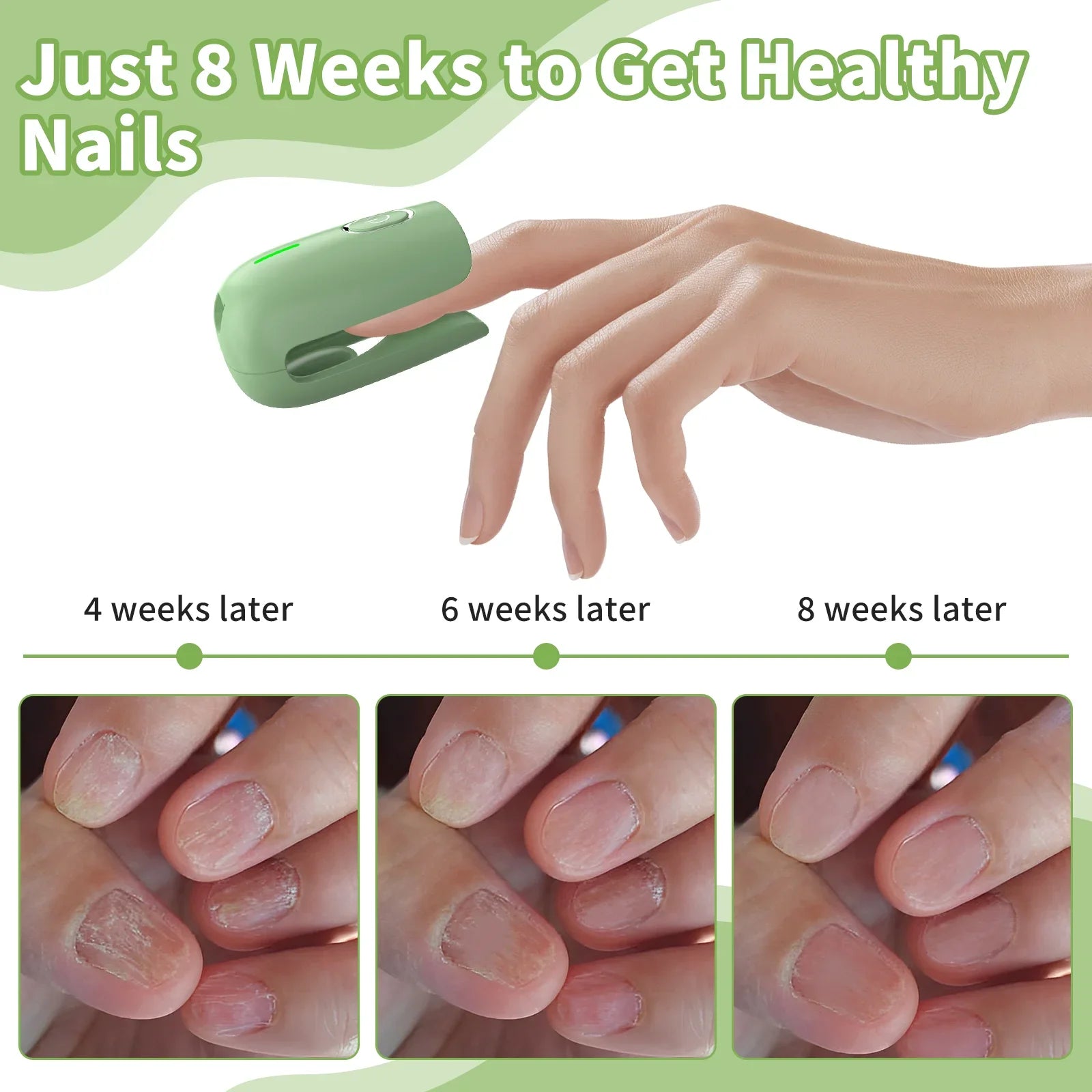 Nail Fungus Cleaning Device, Nail Fungus Cleaning Machine, Portable Nail Thickening and Decolorization Fungus Remover